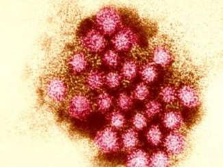 Norovirus outbreak, stomach bug, norovirus symptoms, norovirus prevention, foodborne illness, norovirus cases.